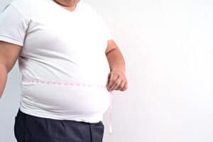 Obesità e fisioterapia