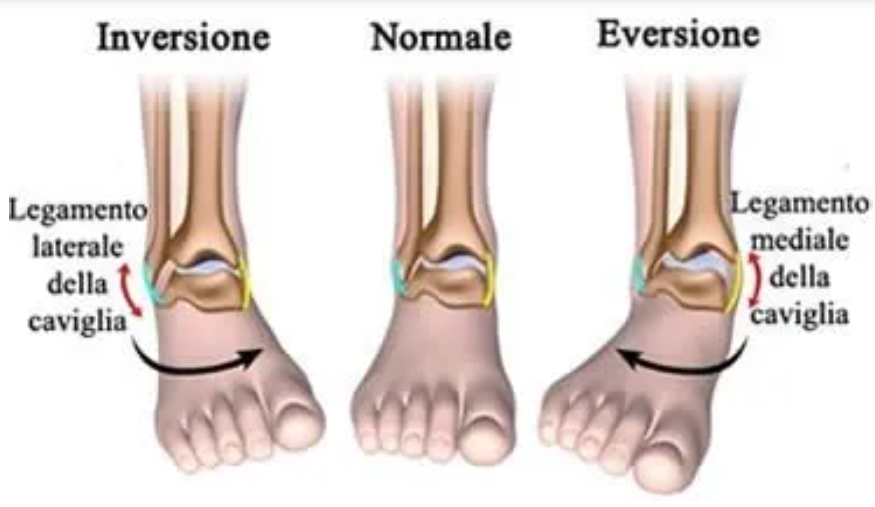 distorsione caviglia