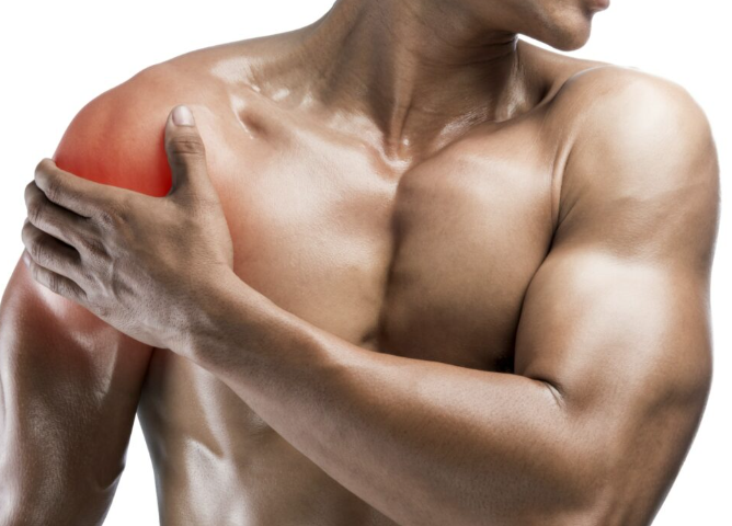 tendinopatia capo lungo bicipite