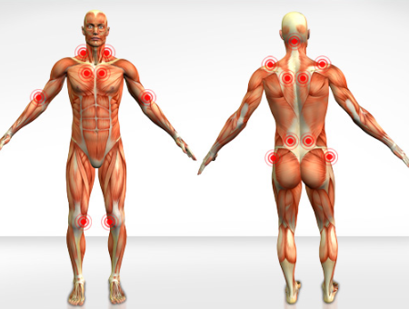 fibromialgia