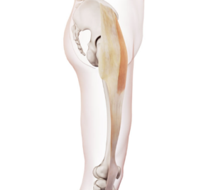 sindrome bandelletta ileotibiale