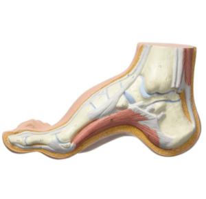 piede cavo definizione cause sintomi