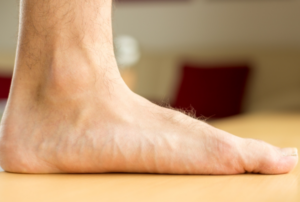 piade piatto definizione causa sintomi